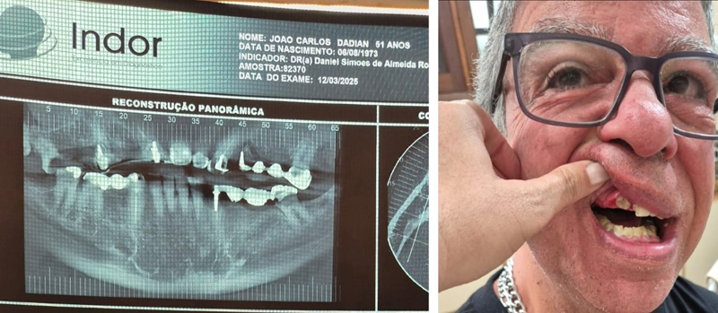 Campanha em prol de Joca mobiliza moradores de Alphaville